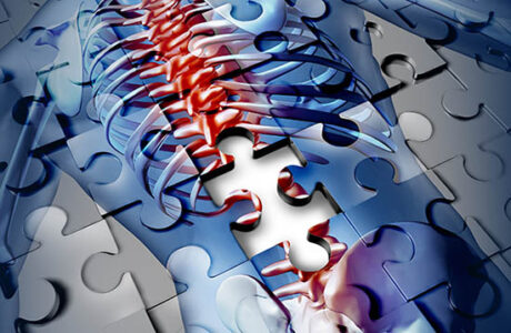 Treating and Prevening Back Pain Image
